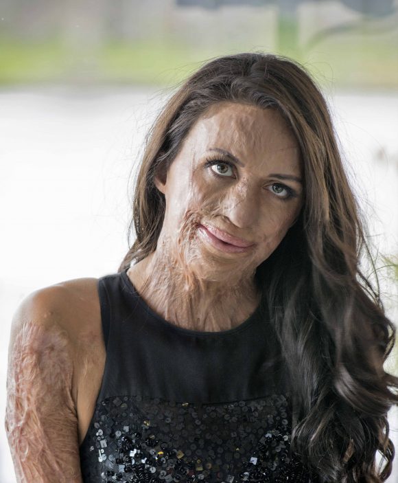 Turia Pitt