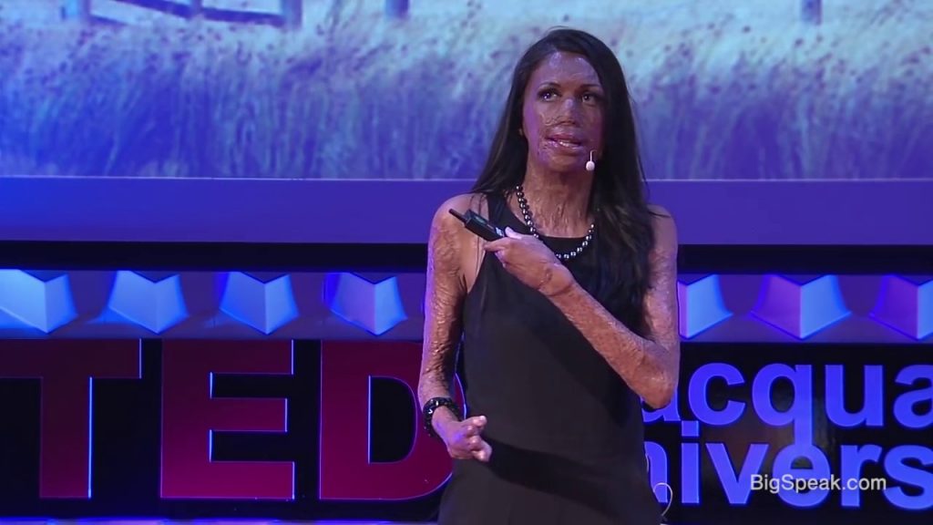 Unmask your potential – Turia Pitt